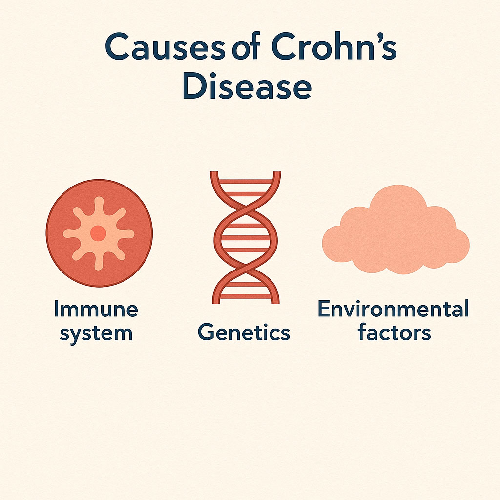 Causes of Crohn’s Disease