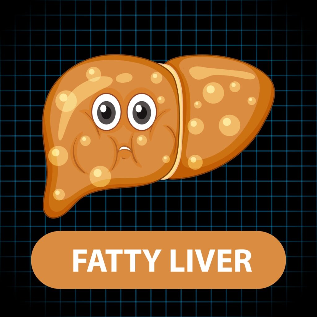Fatty Liver