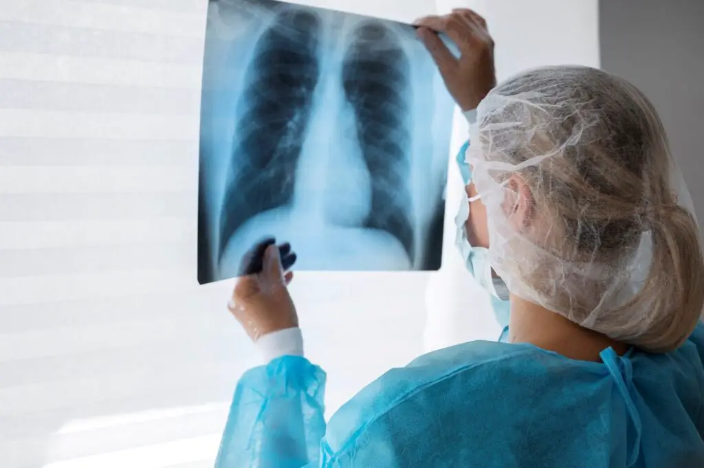 Diagnosis OF Legionnaires' Disease